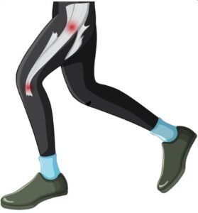 Best limb reconstruction surgeon in East Delhi