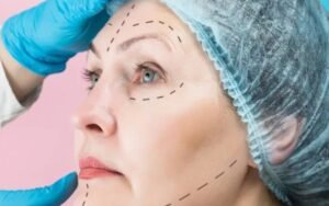 Best Plastic Surgeon in East Delhi