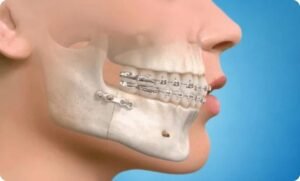 Best Maxillofacial Surgery in Delhi NCR