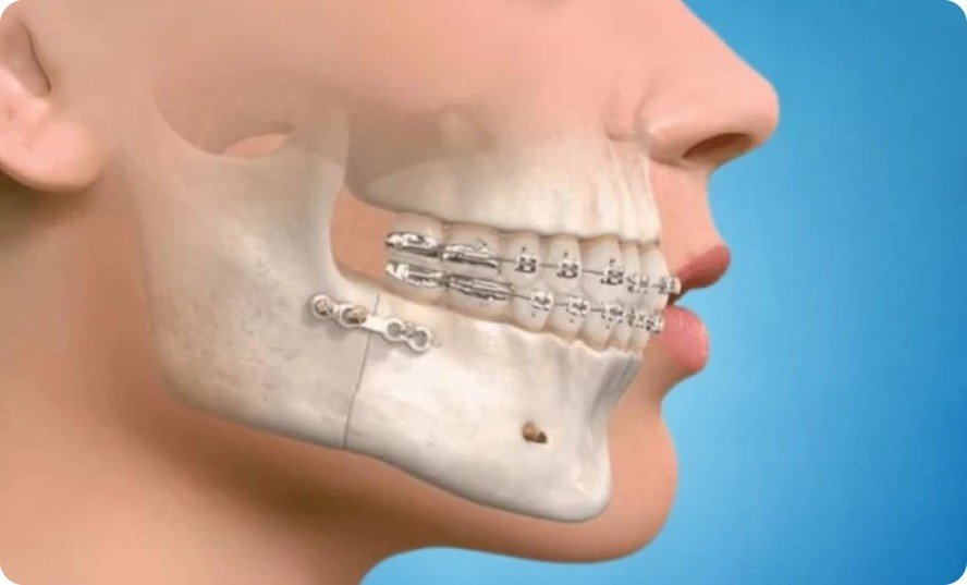 Best Maxillofacial Surgery in Delhi NCR