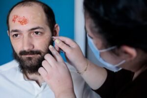 Best Scar Revision Surgeon in Delhi NCR