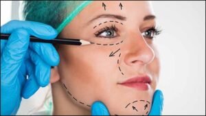 Best Cosmetic Surgery in East Delhi
