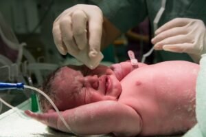 Best Birth Defects Surgeon in Delhi NCR