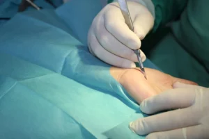 Best Hand Trauma Surgeon in Delhi NCR