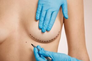 Breast Surgery in Delhi