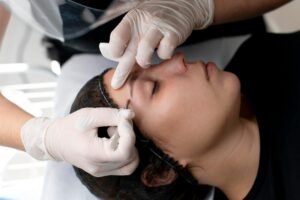 Sebaceous Cyst Removal in Delhi