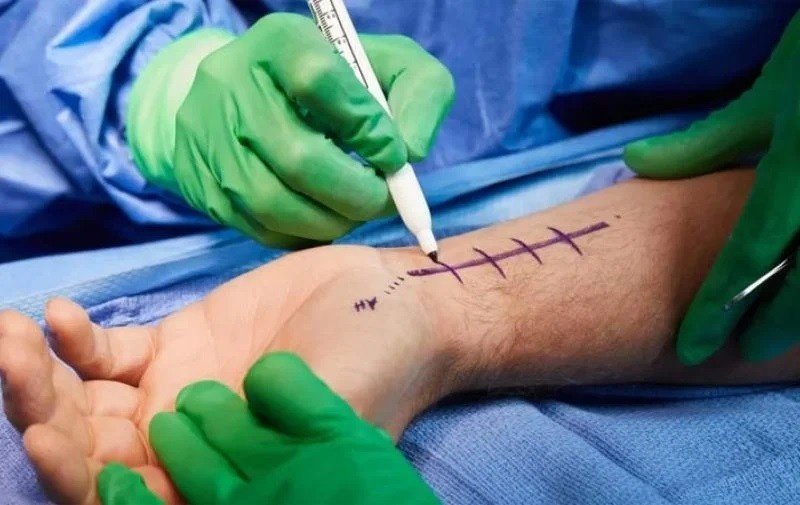 Hand Trauma Surgery in Delhi