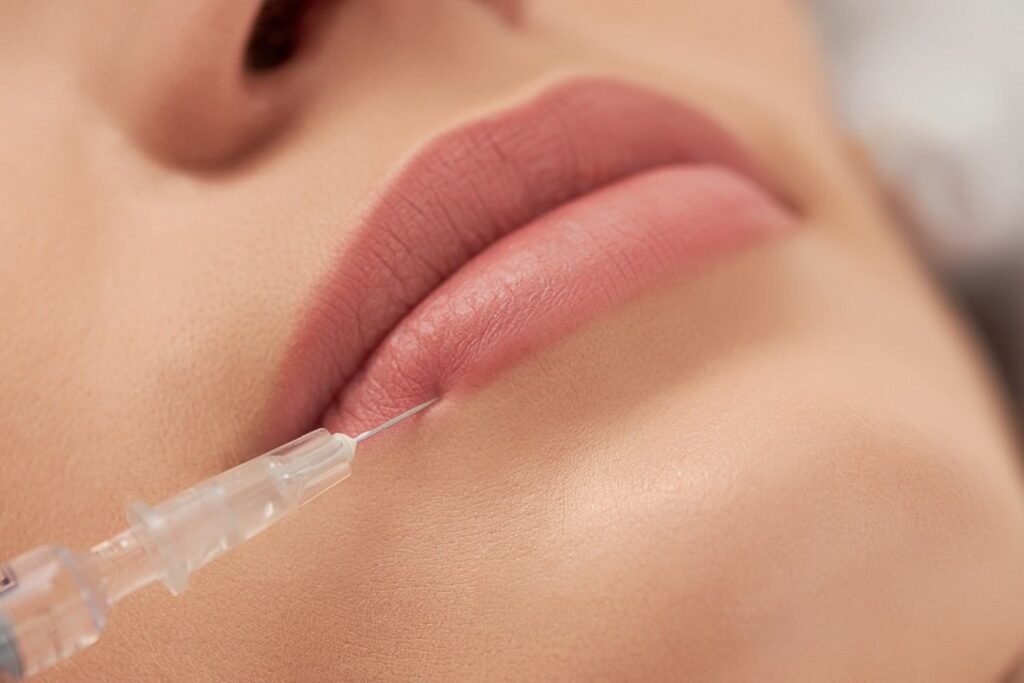 Lip Augmentation in Delhi