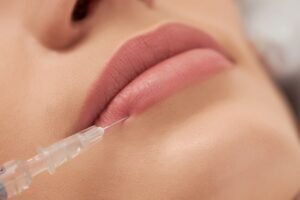 Lip Augmentation in Delhi