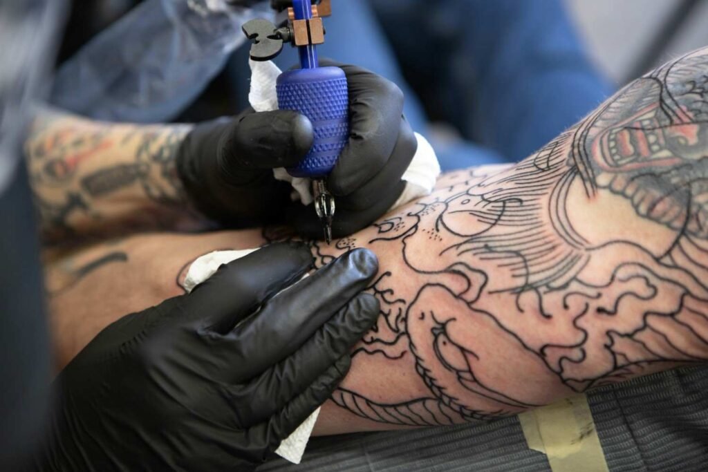 Tattoo Removal in East Delhi