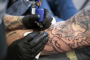 Tattoo Removal in East Delhi