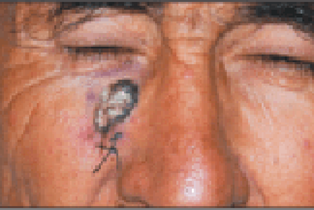 Screenshot 2025-11-01 at 16-20-14 SKIN CL BROCHURE - SKIN CL BROCHURE-3.pdf