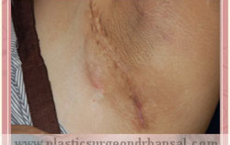 fatgft_aft (1)